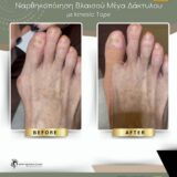 Ποδολογικό Κέντρο Περιστέρι – Λίνα Σαράκη