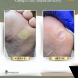 Ποδολογικό Κέντρο Περιστέρι – Λίνα Σαράκη