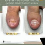 Ποδολογικό Κέντρο Περιστέρι – Λίνα Σαράκη