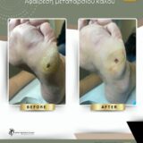 Ποδολόγος Περιστέρι – Λίνα Σαράκη