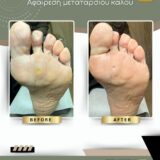 Ποδολογικό Κέντρο Περιστέρι – Λίνα Σαράκη