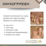 Ποδολογικό Κέντρο Περιστέρι – Λίνα Σαράκη