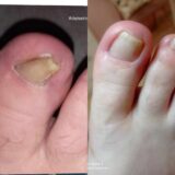 Ποδολόγος - Κοζάνη - Ειρήνη Καρακοντή