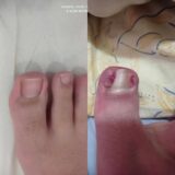 Ποδολόγος - Κοζάνη - Ειρήνη Καρακοντή