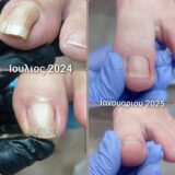 Ποδολόγος – Κοζάνη – Ειρήνη Καρακοντή