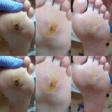 Ποδολόγος – Κοζάνη – Ειρήνη Καρακοντή