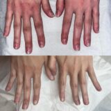 Ποδολόγος – Κοζάνη – Ειρήνη Καρακοντή