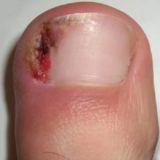 Ποδολόγος - Αλεξανδρούπολη - Πέρσα Κωνσταντινίδου - Medical Steps