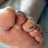 Ποδολόγος - Αλεξανδρούπολη - Πέρσα Κωνσταντινίδου - Medical Steps