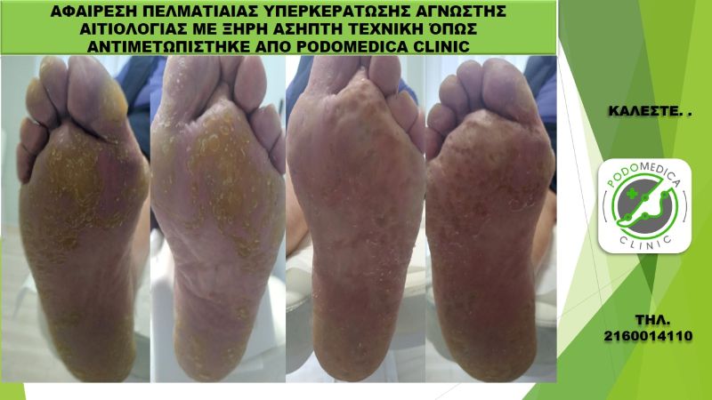Ποδολόγος - Παλαιό Φάληρο - Podomedica Clinic