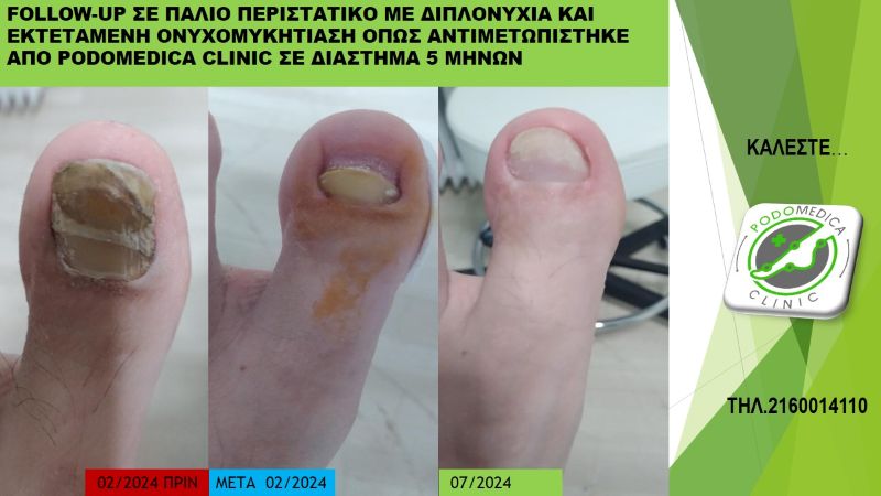 Ποδολόγος - Παλαιό Φάληρο - Podomedica Clinic