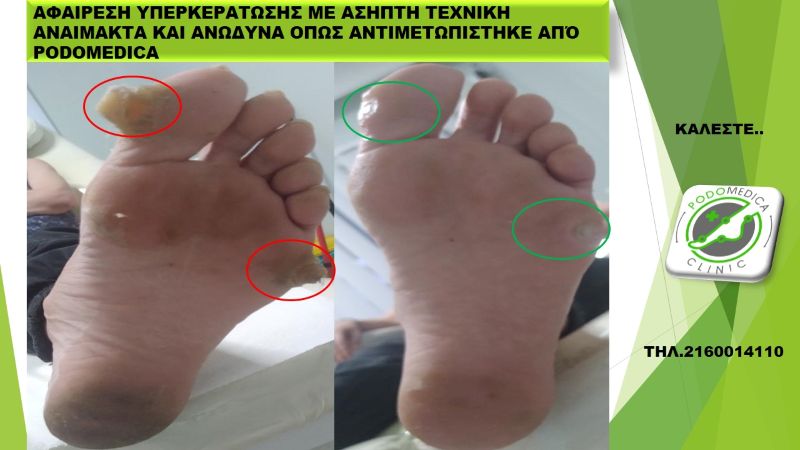Ποδολόγος - Παλαιό Φάληρο - Podomedica Clinic - 3Ν