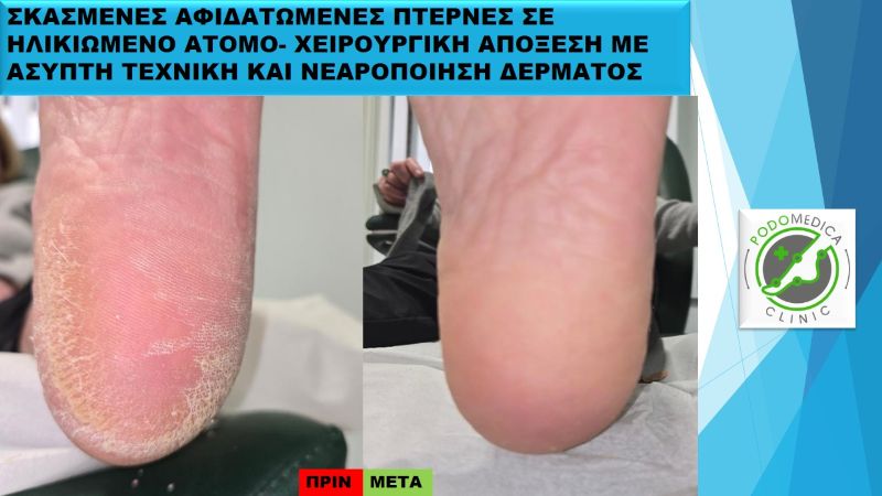 Ποδολόγος - Παλαιό Φάληρο - Podomedica Clinic