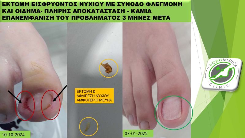 Ποδολόγος - Παλαιό Φάληρο - Podomedica Clinic