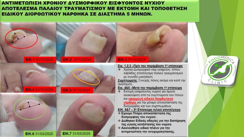 Ποδολόγος - Παλαιό Φάληρο - Podomedica Clinic