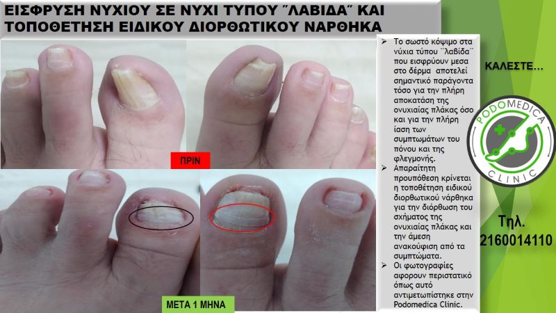 Ποδολόγος - Παλαιό Φάληρο - Podomedica Clinic