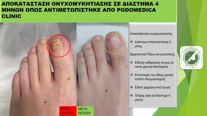 Ποδολόγος - Παλαιό Φάληρο - Podomedica Clinic