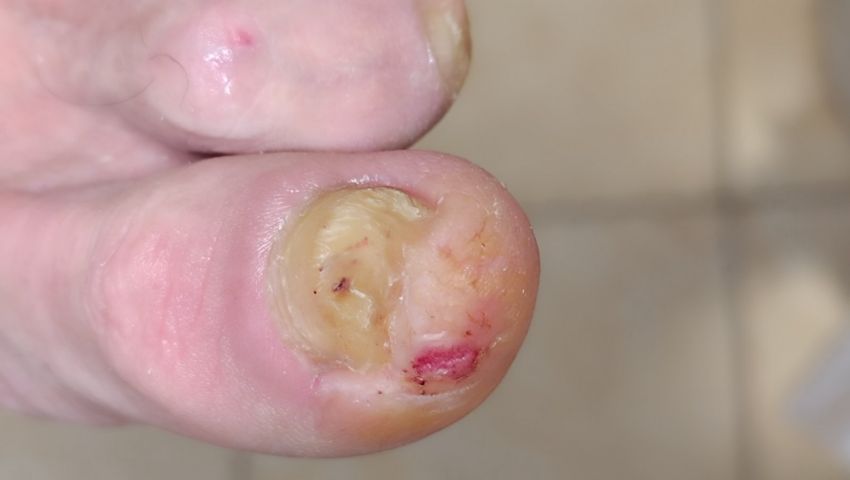 Ποδολόγος - Άγιος Δημήτριος - Step Care